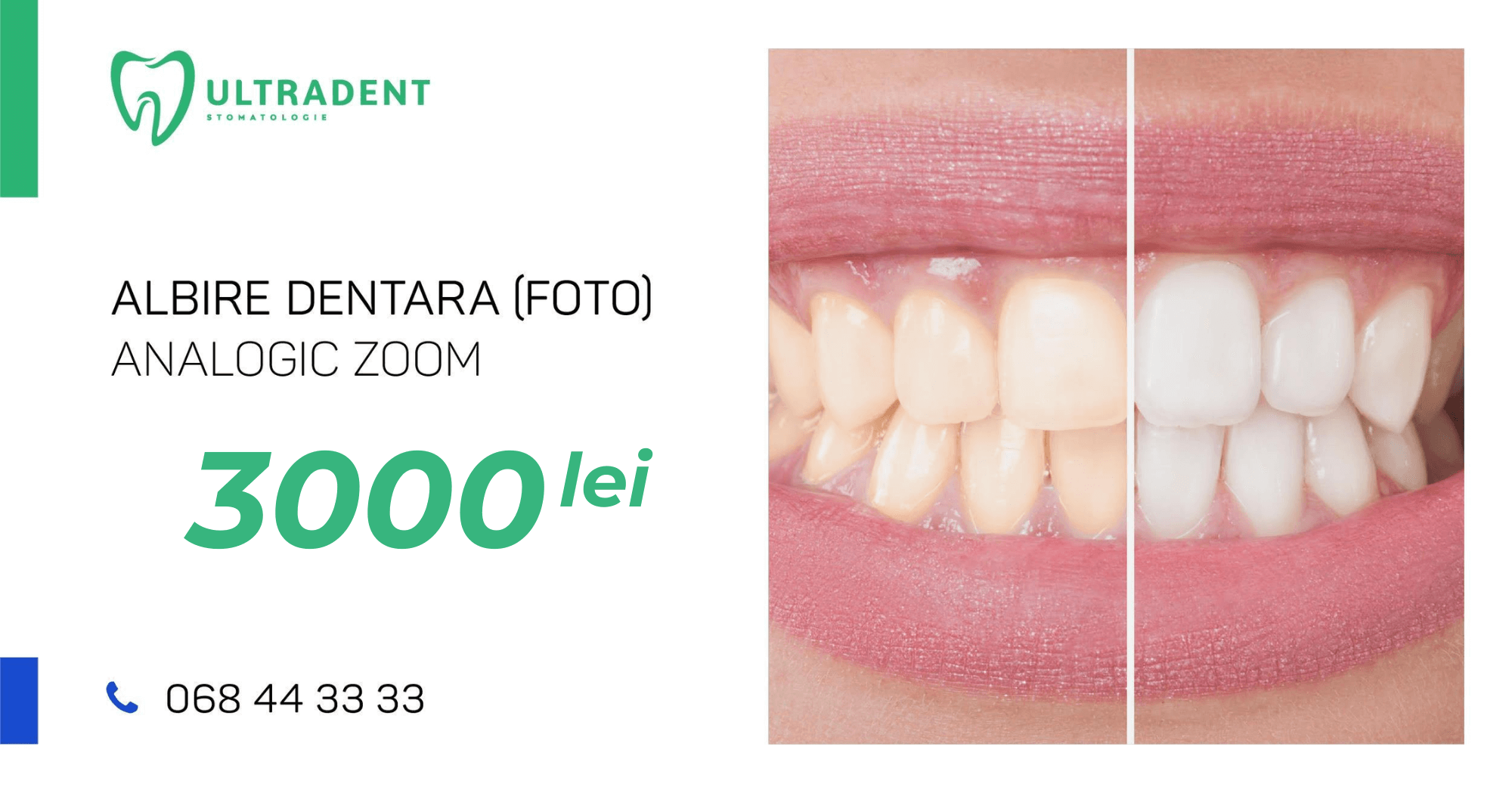 Ultradent Ultradent